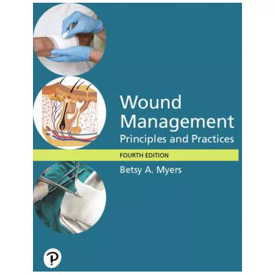 Wound Management